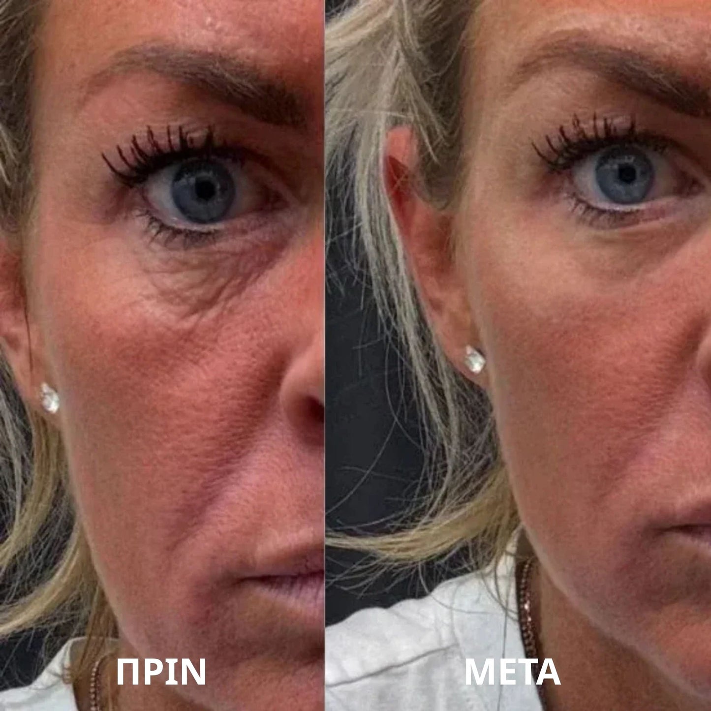 Thea Hydrogel Eye Patches