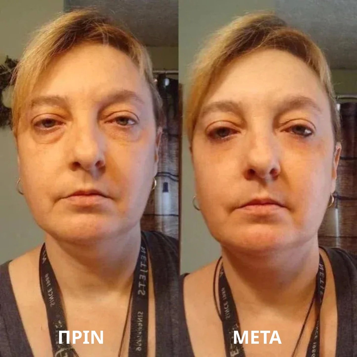 Thea Hydrogel Eye Patches