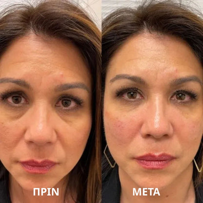 Thea Deep Peptide Collagen Eye Mask
