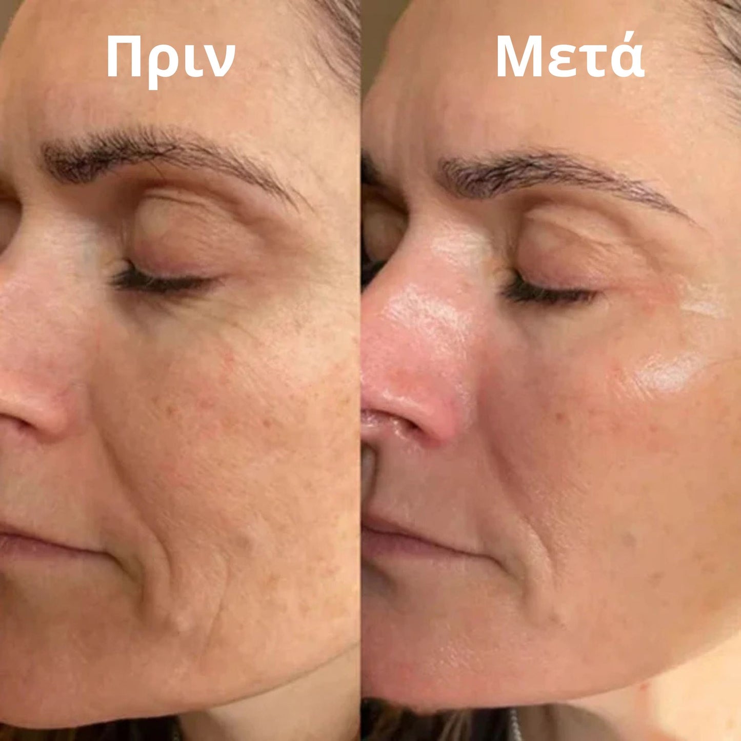 Thea Collagen Balm